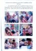 โครงการส่งเสริมทันตสุขภาพในเด็กแรกเกิดถึง2ปี 